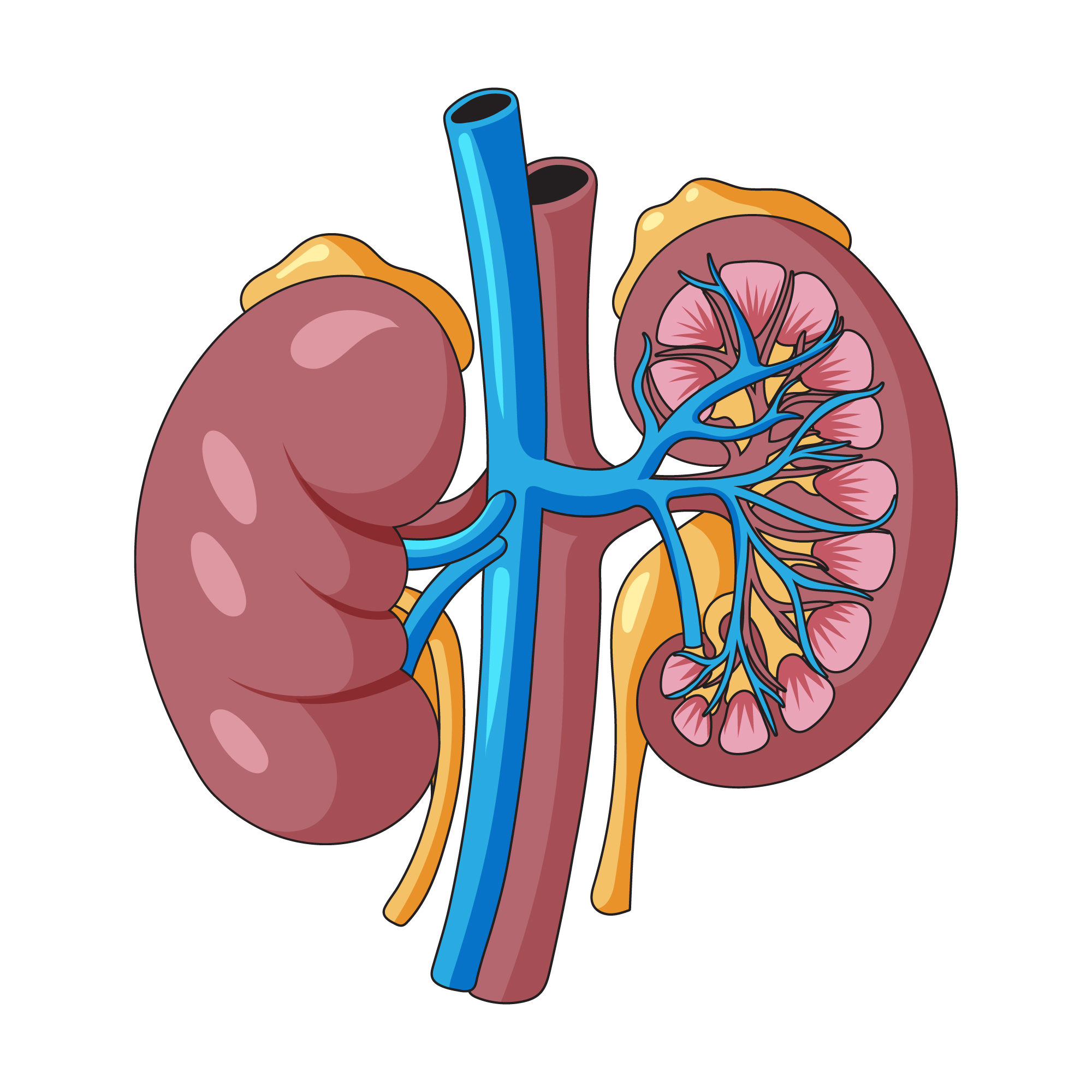 adrenal cancer