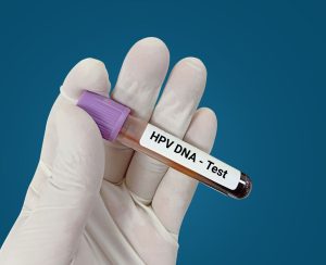 HPV DNA test