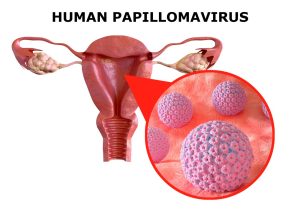 Human papillomavirus (HPV)