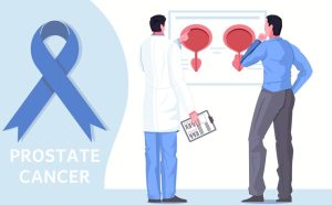 prostrate cancer checkup