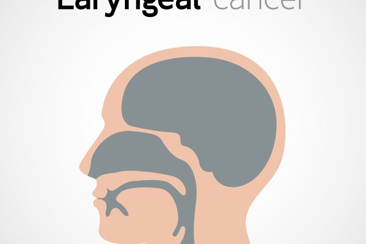 Understanding Laryngeal Cancer: Causes, Symptoms, Diagnosis, and Treatment