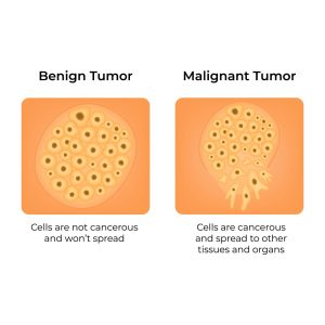 Benign and Malignant Tumours