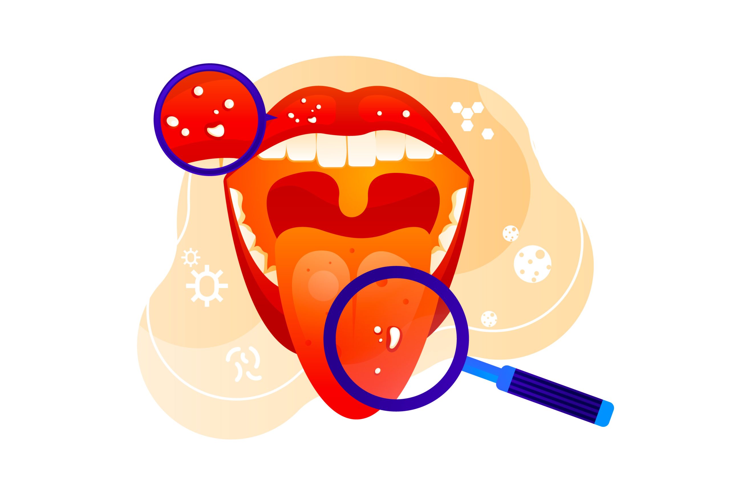 Oral Cancer: Causes, Symptoms, Diagnosis, Treatment